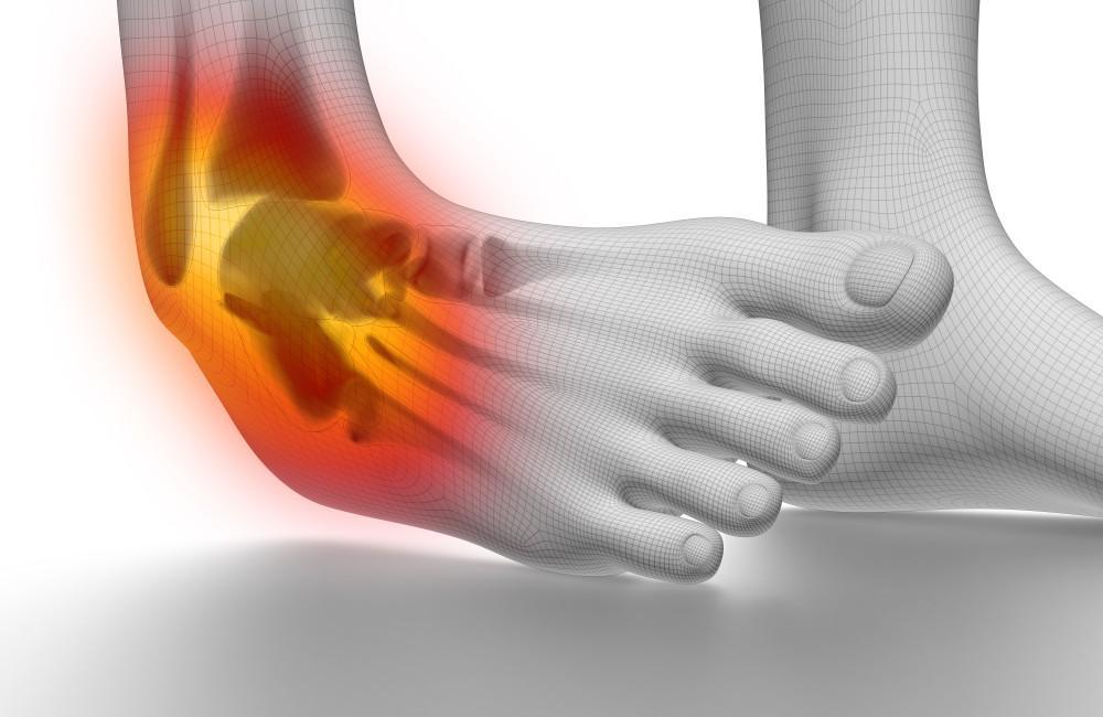 ATFL Sprain Overview