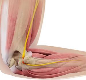 Cubital Tunnel Syndrome Overview