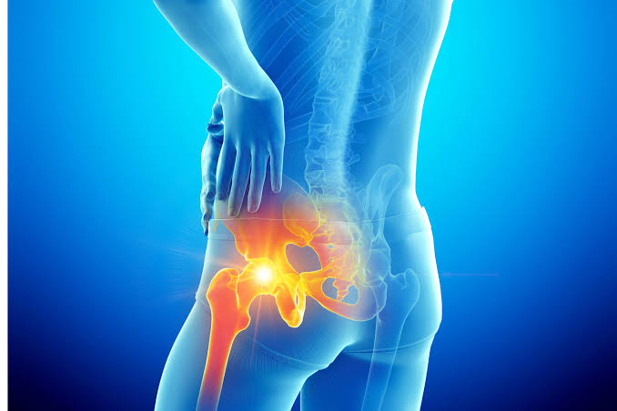 AVN Hip Pain Overview