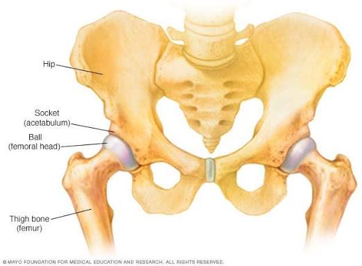 Legg-Calve-Perthes Disease Overview