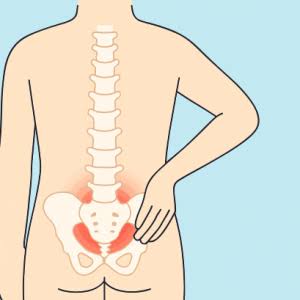 Coccydynia Overview
