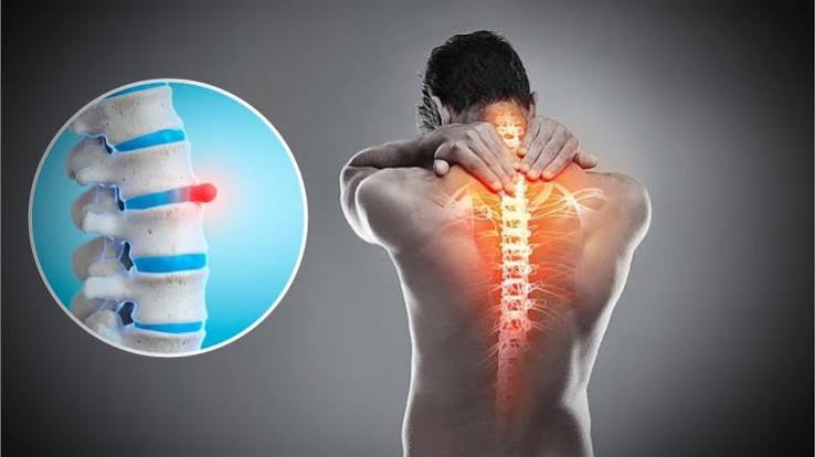 Slip Disc and Pelvic Girdle Pain