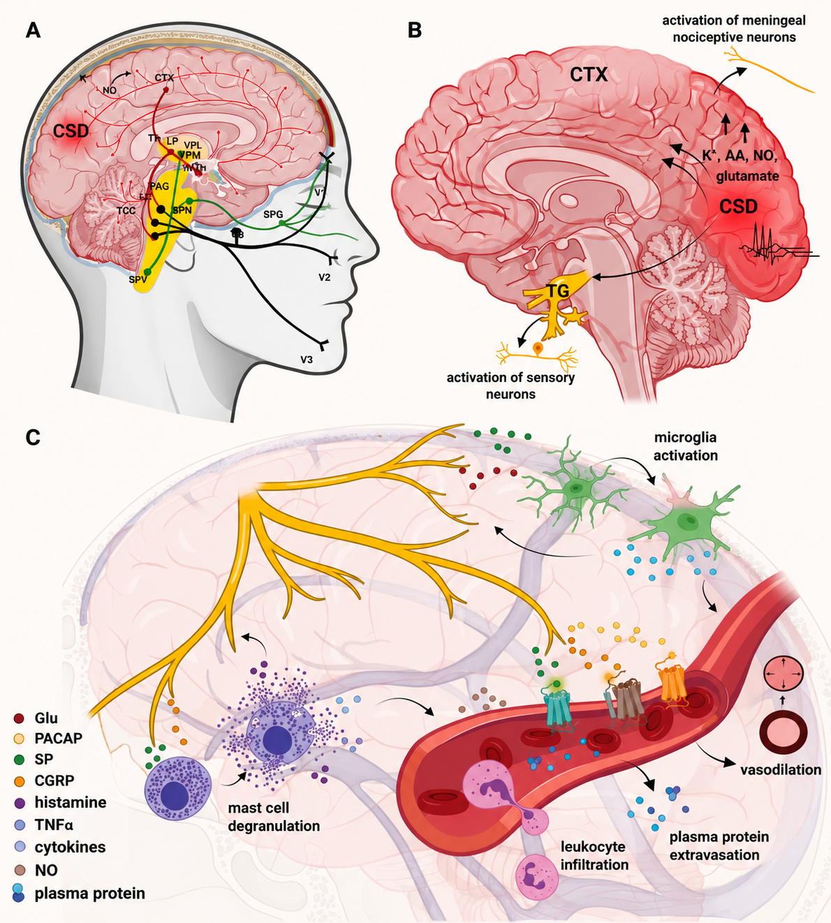Migraine Overview